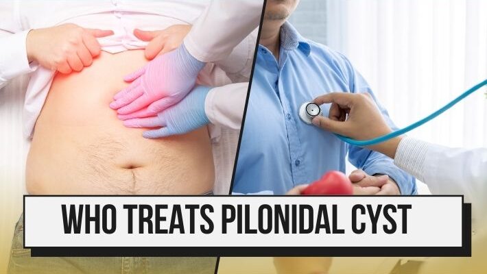 who treats pilonidal cyst