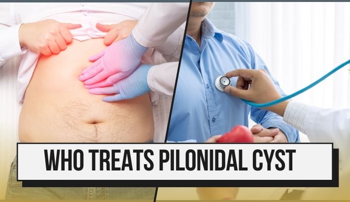 who treats pilonidal cyst