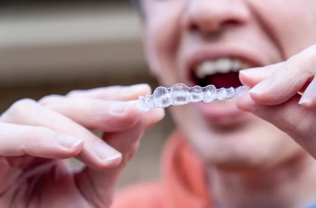 Invisalign Dentist in Aberdeen