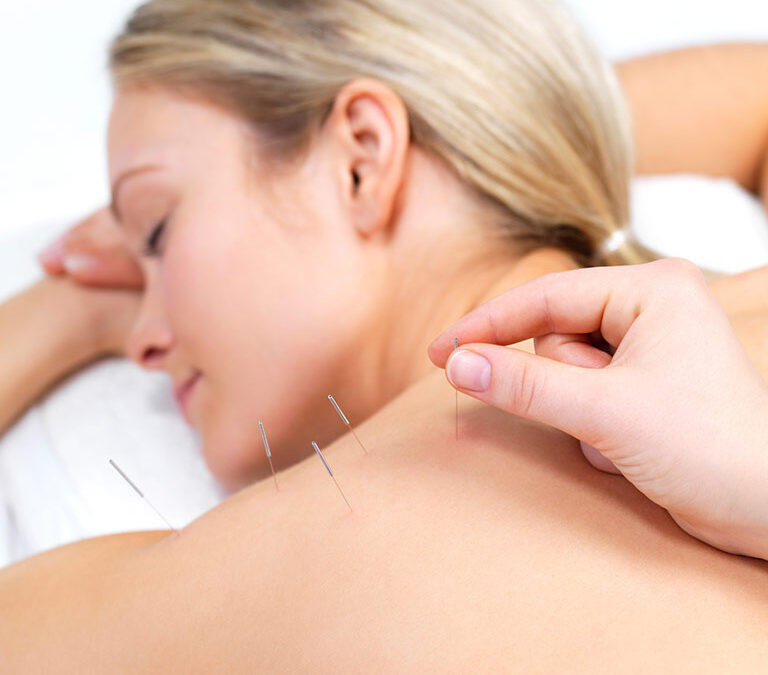 Acupuncture in Surrey BC