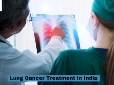 lung cancer treatment