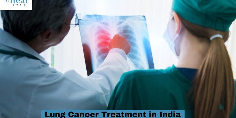 lung cancer treatment