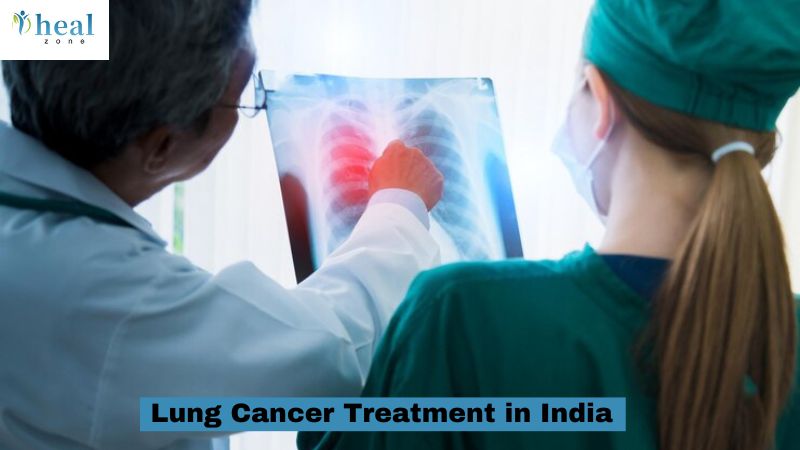 lung cancer treatment