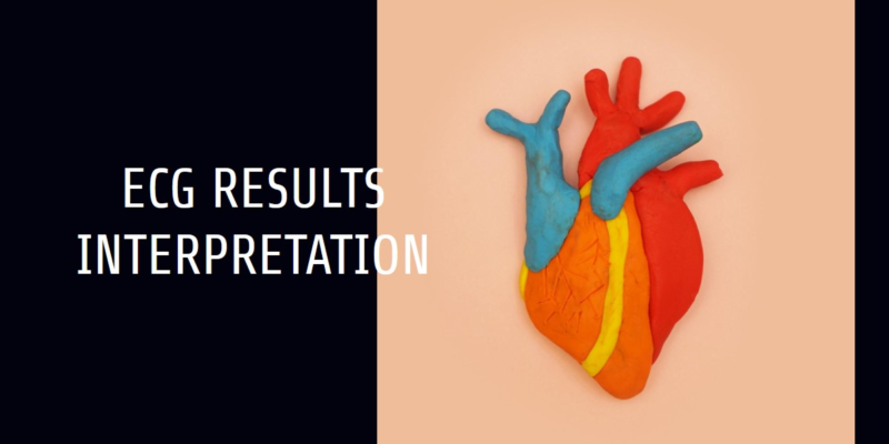 ECG Results