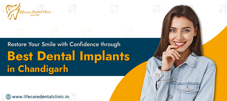 dental implants in chandigarh