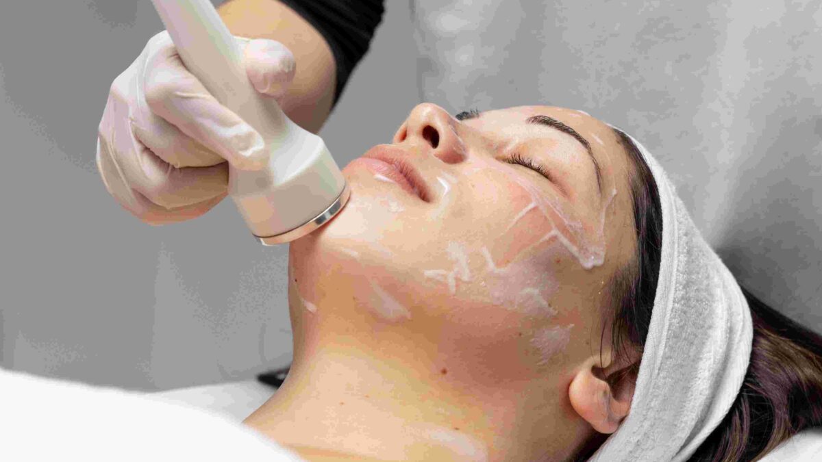 Chemical Peel in Mississauga