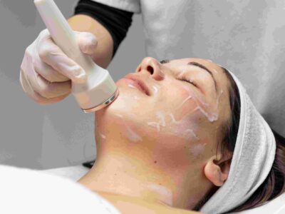 Chemical Peel in Mississauga