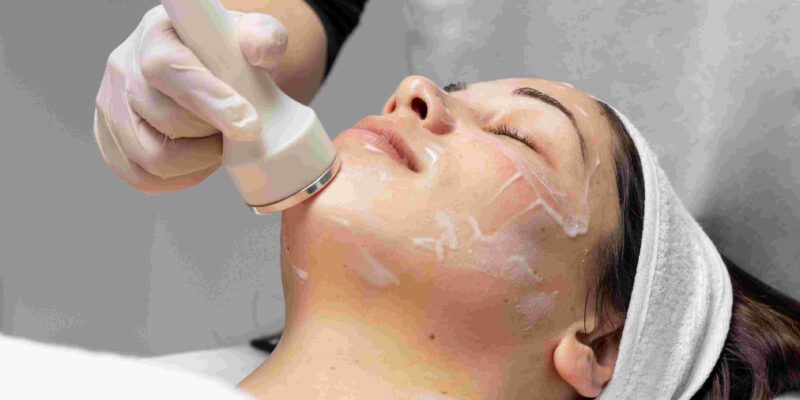 Chemical Peel in Mississauga