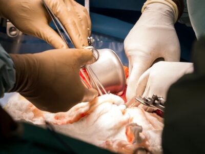 Colorectal Surgeons Treat Colon and Rectal Injuries