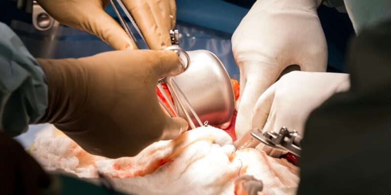 Colorectal Surgeons Treat Colon and Rectal Injuries