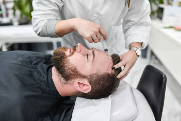 Hair Transplant in Riyadh