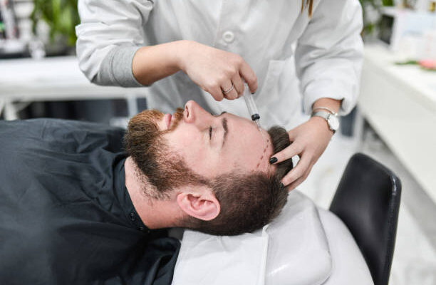 Hair Transplant in Riyadh