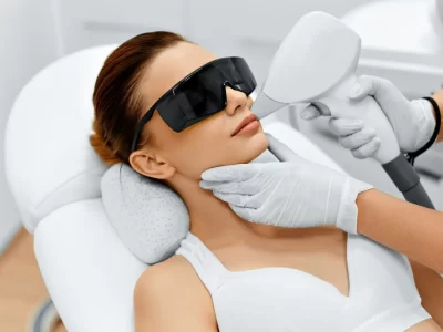 laser hair removal