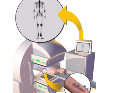 The Impact of 3D Animation on Medical Device Design and Prototyping