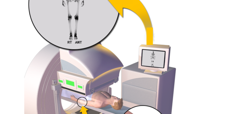 The Impact of 3D Animation on Medical Device Design and Prototyping