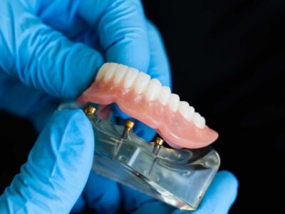 Surgical-dentures-calgary-ab-swiss-denture-