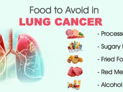 Foods to Avoid for Lung Cancer Patients