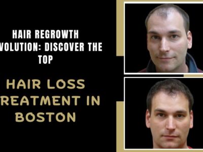 Hair-Regrowth-Revolution-Discover-the-Top-Hair-Loss-Treatment-in-Boston