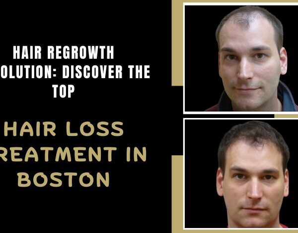 Hair-Regrowth-Revolution-Discover-the-Top-Hair-Loss-Treatment-in-Boston