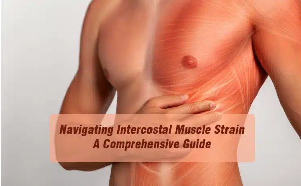 Intercostal muscle strain