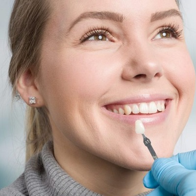 Pros and Cons of Choosing Composite Veneers for Your Teeth