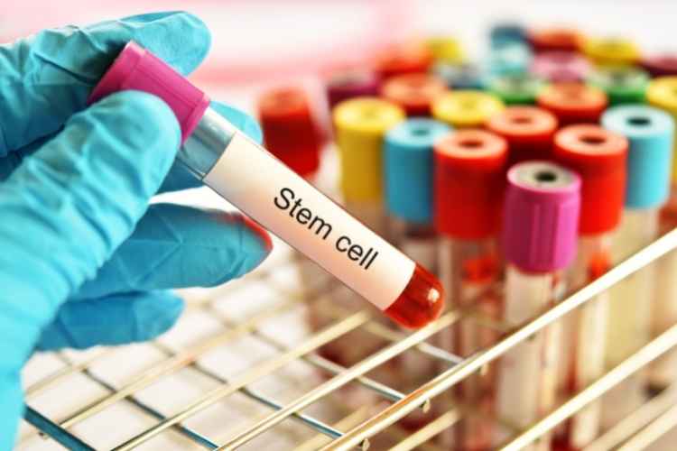 What Is Stem Cell Banking and How Can It Benefit My Family?