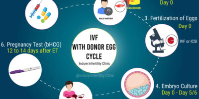 egg donation