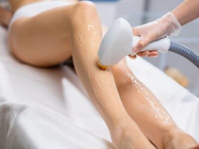 Laser hair removal in riyadh