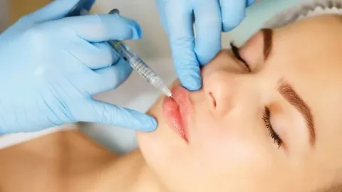 Lip Fillers Injection in Riyadh