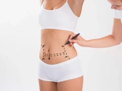 Liposuction Surgery in Jeddah