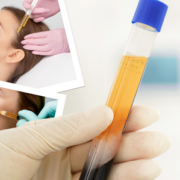 PRP therapy Suffolk County