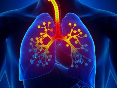 Best Asthma Doctor in Delhi