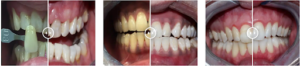 cosmetic dentistry cardiff