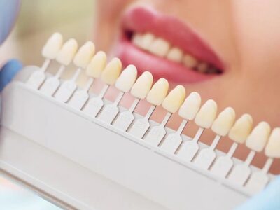 teeth whitening cardiff